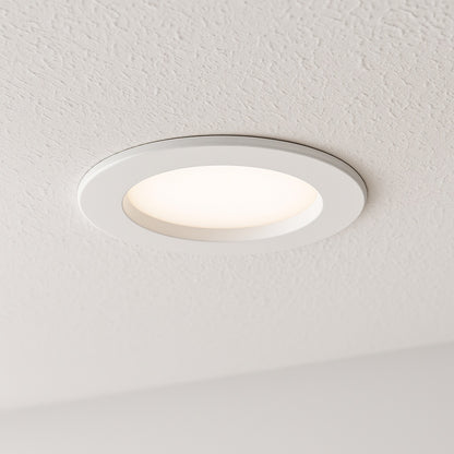 SMD-DM 6 in. 3000K Remodel Canless Lens White Round Integrated LED Recessed Light Kit Surface Mount Trim Kit